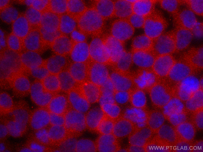 ADRBK1 Antibody in Immunocytochemistry (ICC/IF)
