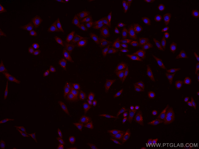 CES1 Antibody in Immunocytochemistry (ICC/IF)