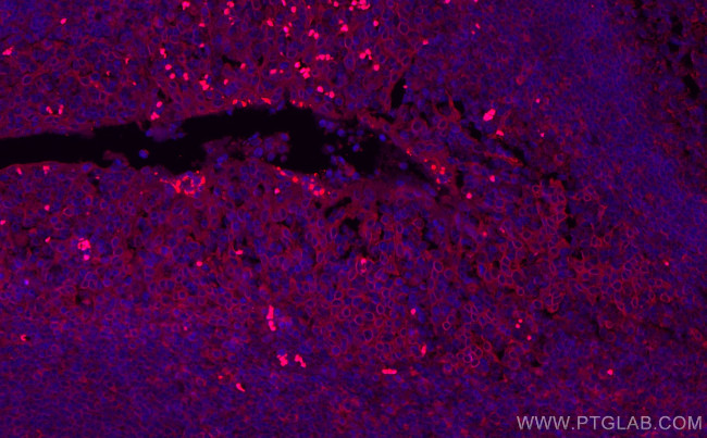 ABCA7 Antibody in Immunohistochemistry (PFA fixed) (IHC (PFA))