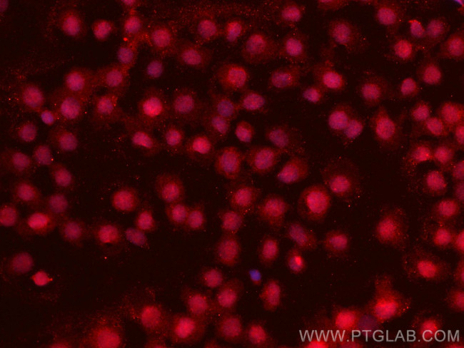 IRF8 Antibody in Immunocytochemistry (ICC/IF)