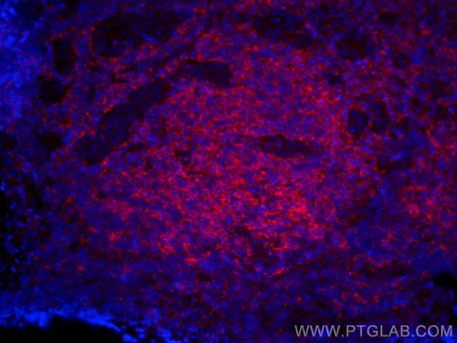 RIAM, APBB1IP Antibody in Immunohistochemistry (PFA fixed) (IHC (PFA))