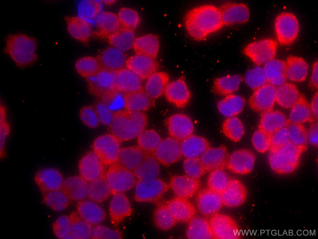 CDC25B Antibody in Immunocytochemistry (ICC/IF)