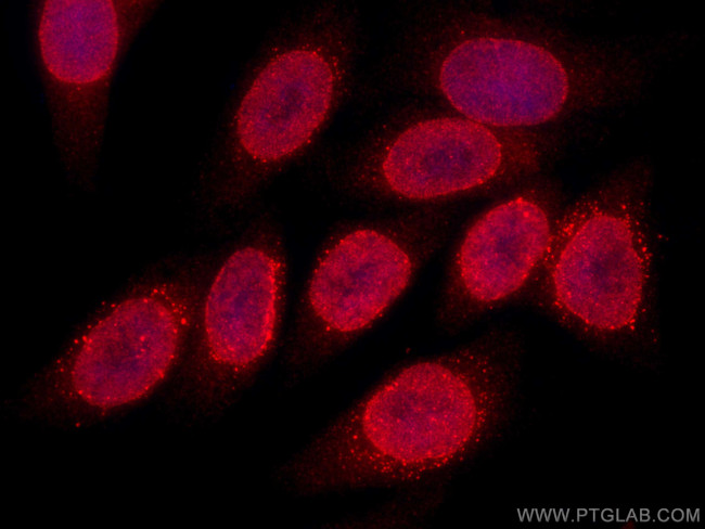 RANGAP1 Antibody in Immunocytochemistry (ICC/IF)