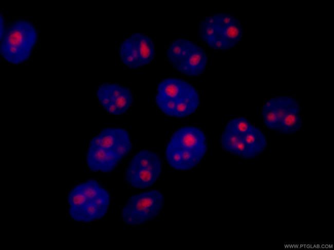 GNL3 Antibody in Immunocytochemistry (ICC/IF)