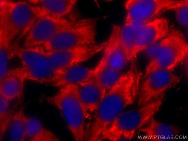 GPI Antibody in Immunocytochemistry (ICC/IF)