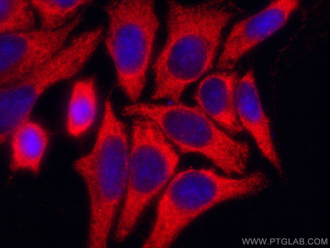 DNAJA1 Antibody in Immunocytochemistry (ICC/IF)