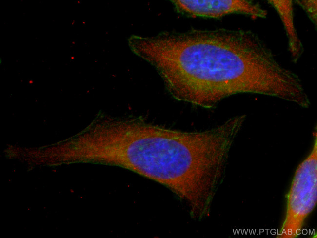 Cytohesin 2 Antibody in Immunocytochemistry (ICC/IF)