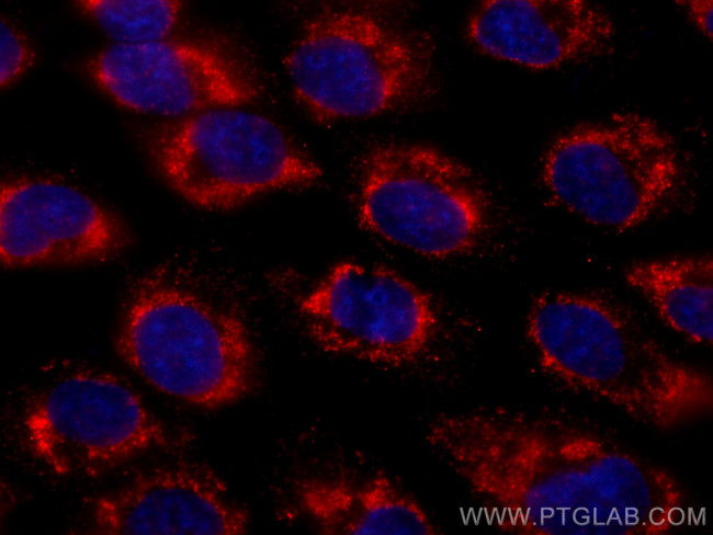 GNMT Antibody in Immunocytochemistry (ICC/IF)