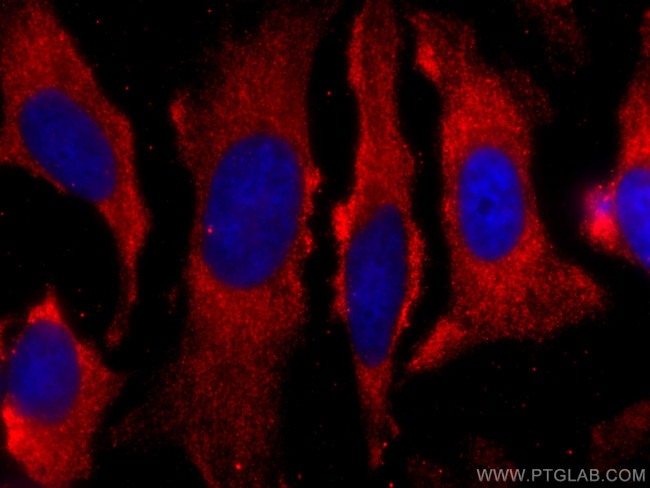TRAF2 Antibody in Immunocytochemistry (ICC/IF)