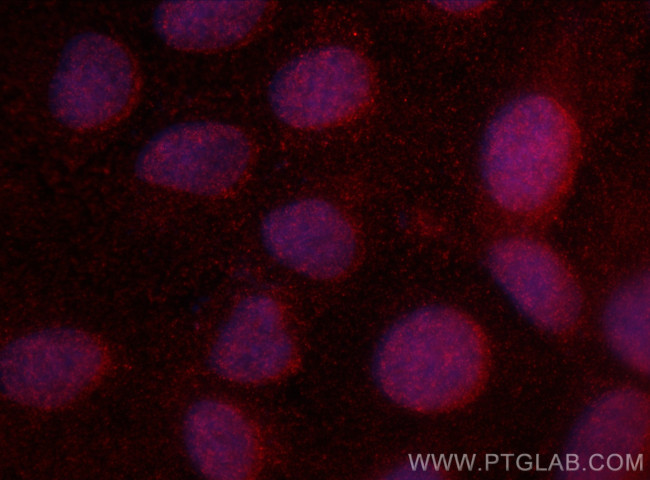 ARL2BP Antibody in Immunocytochemistry (ICC/IF)