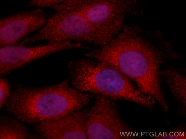 MAP2K4 Antibody in Immunocytochemistry (ICC/IF)
