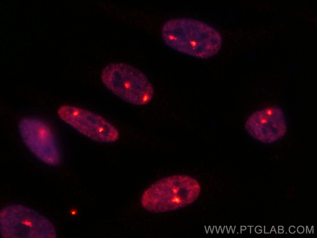 TH1L Antibody in Immunocytochemistry (ICC/IF)
