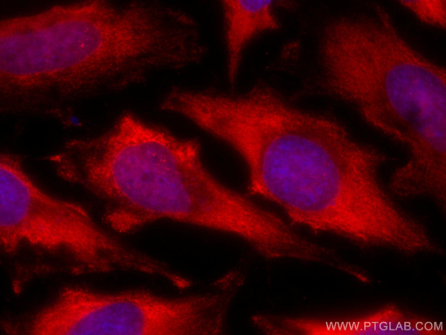 TSG101 Antibody in Immunocytochemistry (ICC/IF)