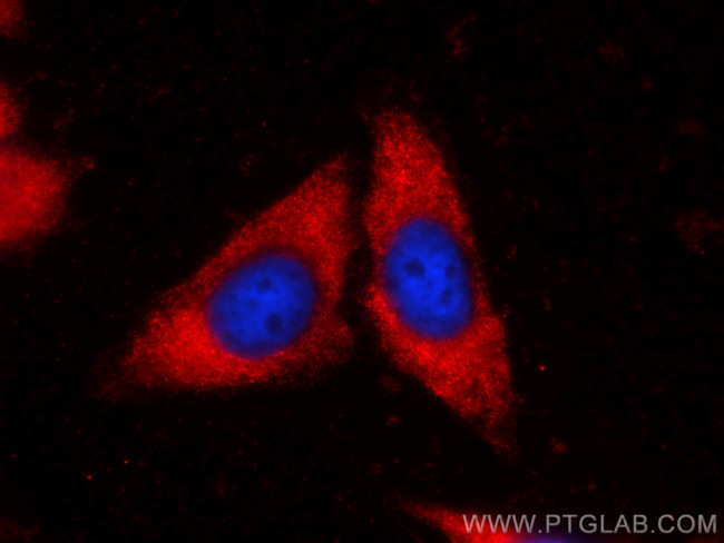 FGL1 Antibody in Immunocytochemistry (ICC/IF)