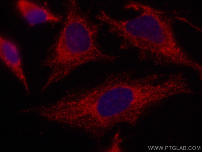 Caspase 4 Antibody in Immunocytochemistry (ICC/IF)