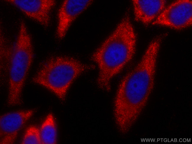 TYK2 Antibody in Immunocytochemistry (ICC/IF)