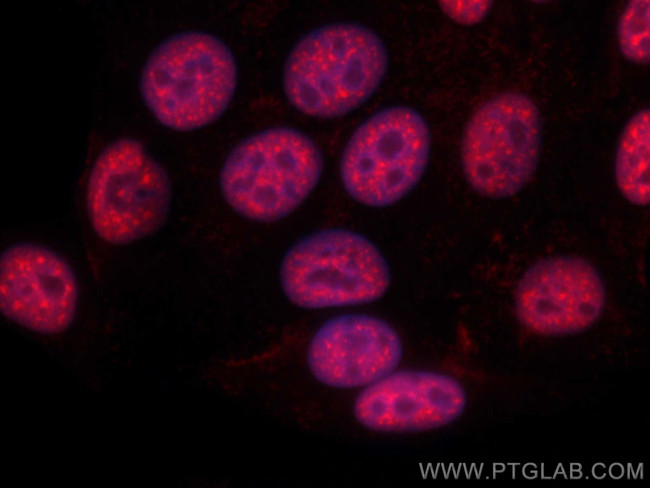 RBM39 Antibody in Immunocytochemistry (ICC/IF)