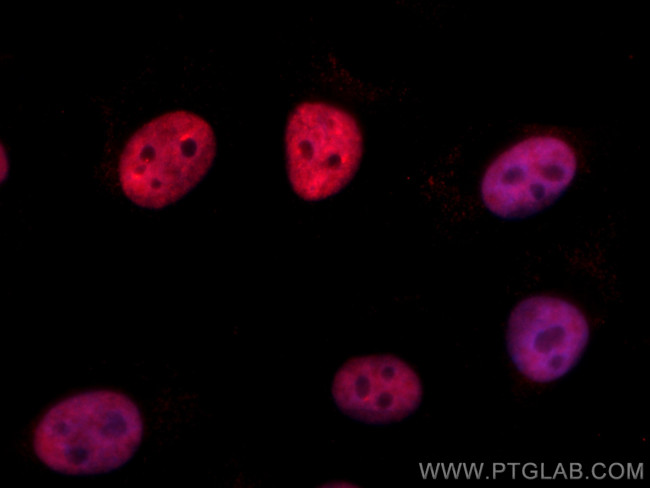PTBP1 Antibody in Immunocytochemistry (ICC/IF)