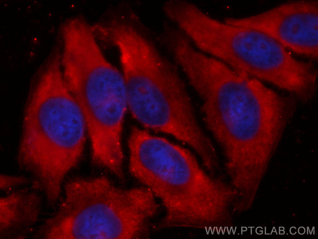 PGAM1 Antibody in Immunocytochemistry (ICC/IF)