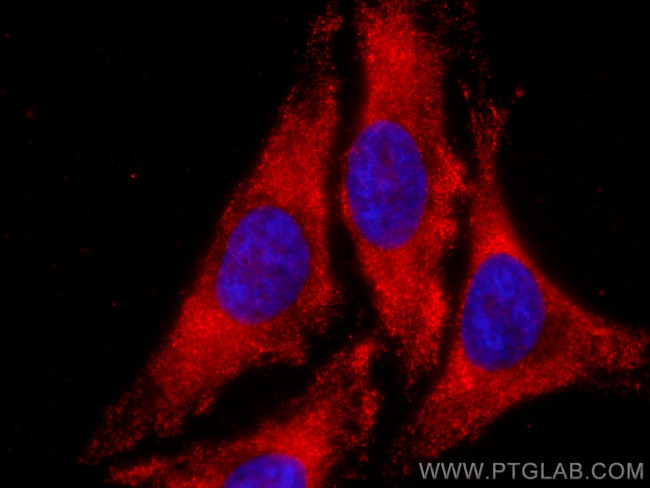 TPI1 Antibody in Immunocytochemistry (ICC/IF)