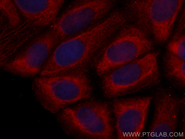 CCT8 Antibody in Immunocytochemistry (ICC/IF)
