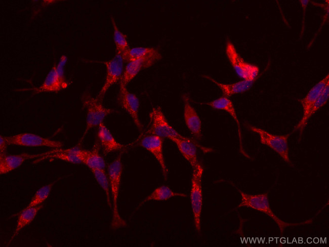FAAH Antibody in Immunocytochemistry (ICC/IF)