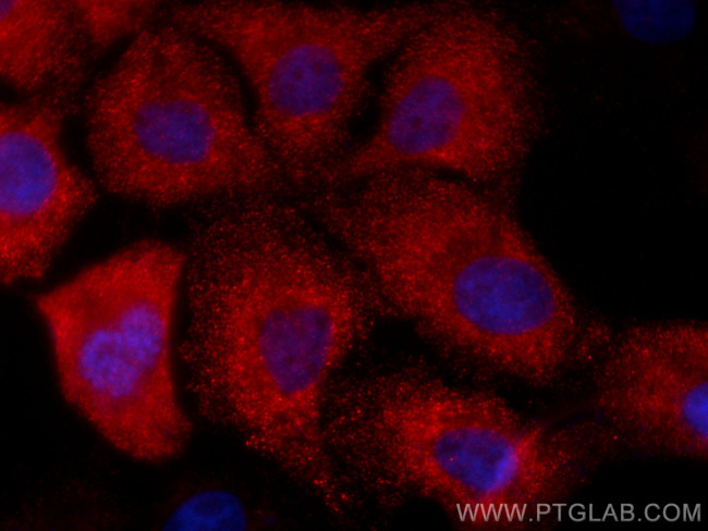 GSTM3 Antibody in Immunocytochemistry (ICC/IF)