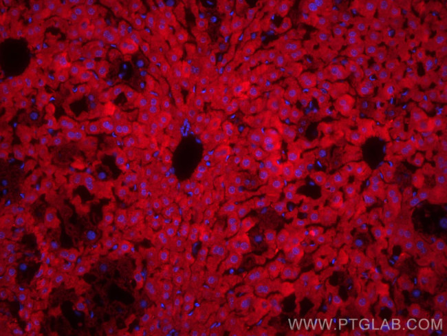 GSTT1 Antibody in Immunohistochemistry (PFA fixed) (IHC (PFA))