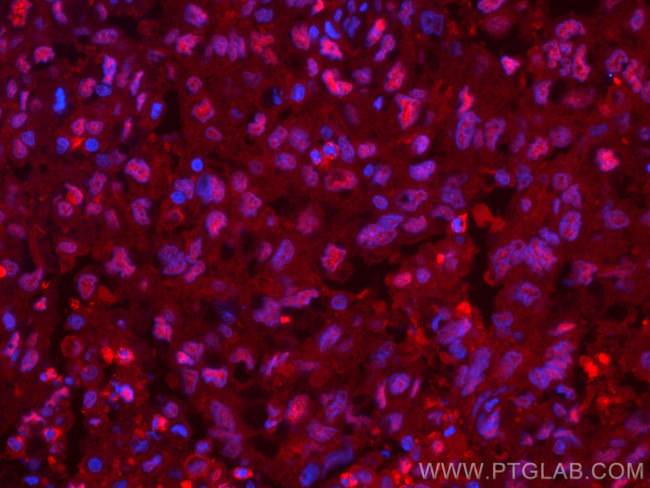 PSMA6 Antibody in Immunohistochemistry (PFA fixed) (IHC (PFA))