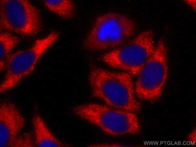 TAK1 Antibody in Immunocytochemistry (ICC/IF)