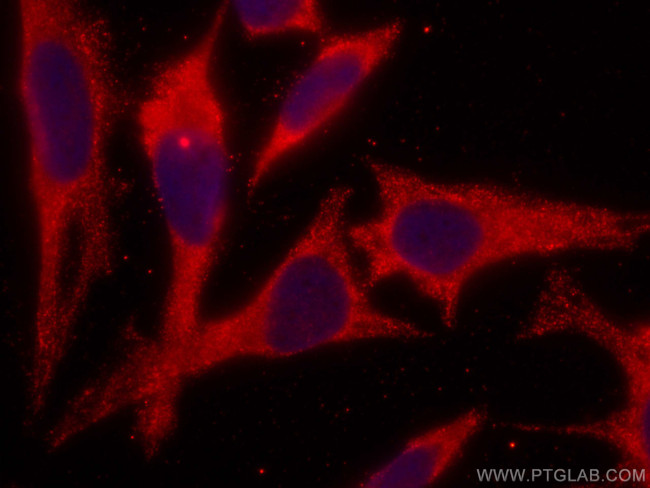NARS Antibody in Immunocytochemistry (ICC/IF)