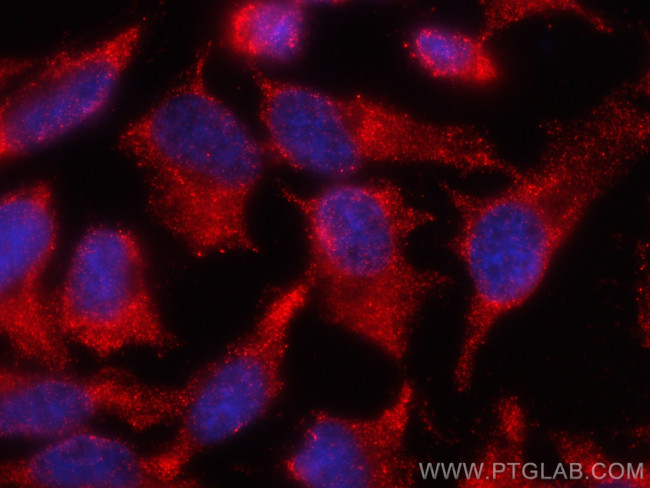Alix Antibody in Immunocytochemistry (ICC/IF)
