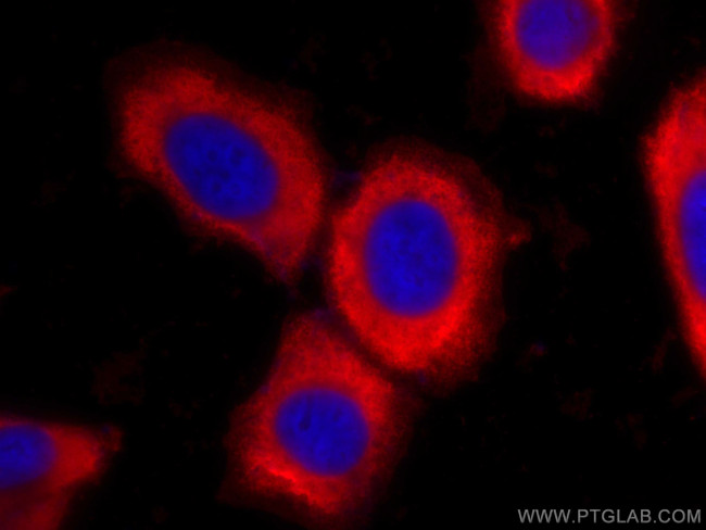 RPL6 Antibody in Immunocytochemistry (ICC/IF)