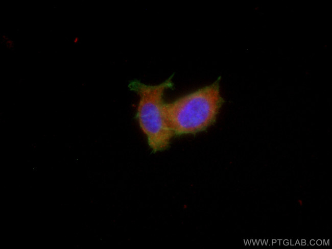 CTPS2 Antibody in Immunocytochemistry (ICC/IF)
