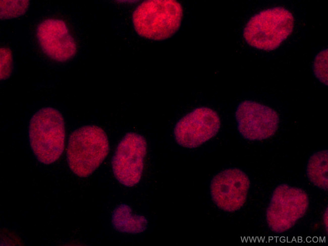 ANKRD1 Antibody in Immunocytochemistry (ICC/IF)