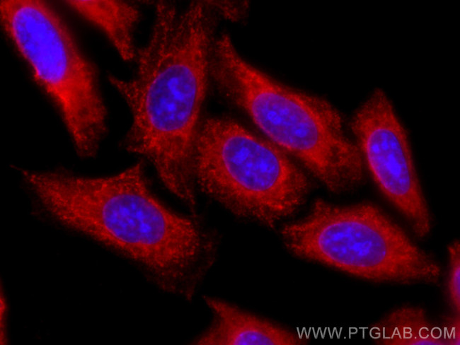 USP11 Antibody in Immunocytochemistry (ICC/IF)