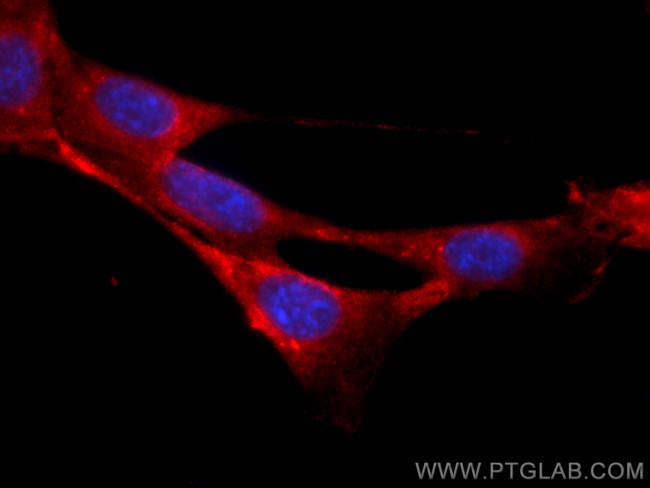 RAB1B Antibody in Immunocytochemistry (ICC/IF)