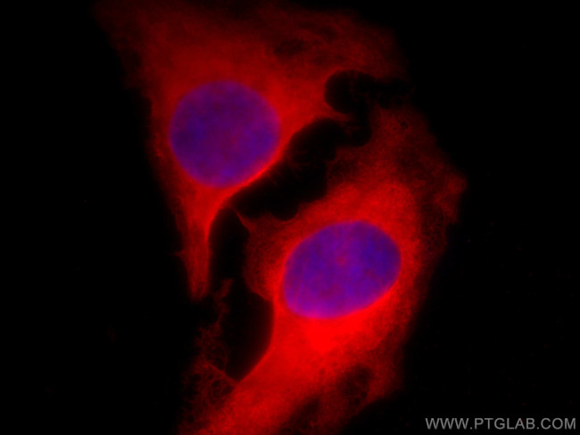 CIP2A Antibody in Immunocytochemistry (ICC/IF)