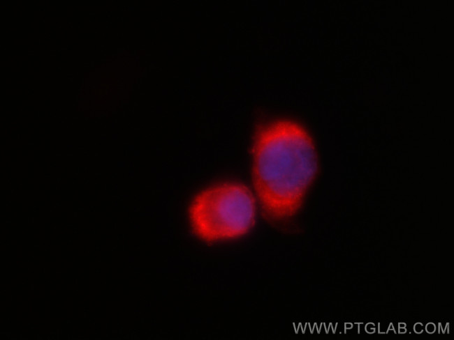 FARSB Antibody in Immunocytochemistry (ICC/IF)