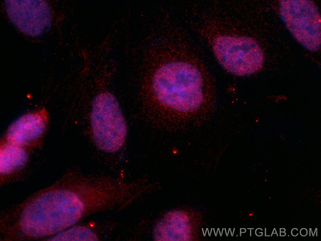 TNIK Antibody in Immunocytochemistry (ICC/IF)