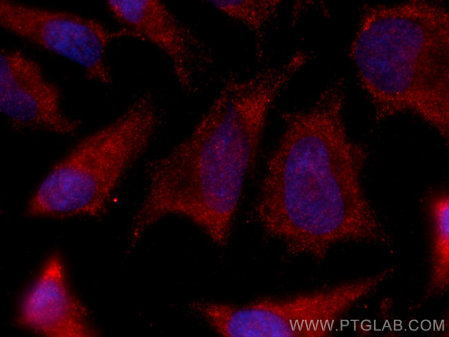 DDX1 Antibody in Immunocytochemistry (ICC/IF)