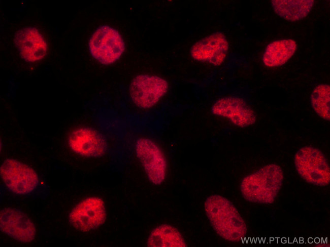 RPA2 Antibody in Immunocytochemistry (ICC/IF)