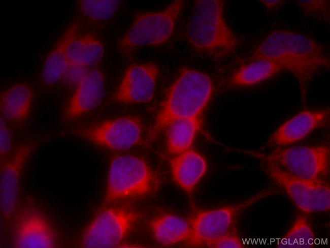 ALDH3A1 Antibody in Immunocytochemistry (ICC/IF)