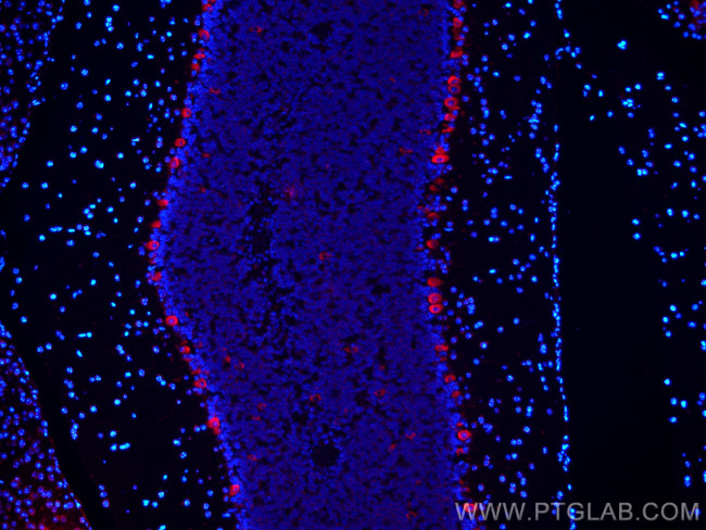 RPL9 Antibody in Immunohistochemistry (PFA fixed) (IHC (PFA))