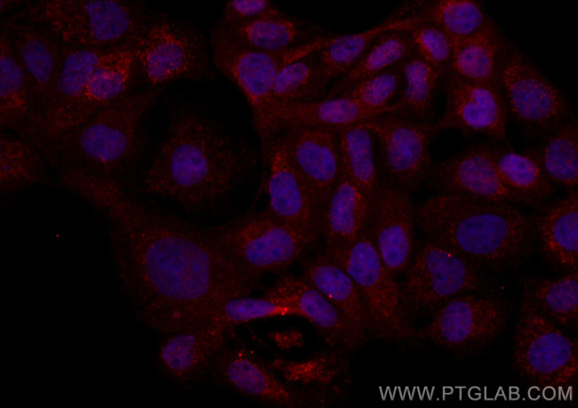 NSFL1C Antibody in Immunocytochemistry (ICC/IF)