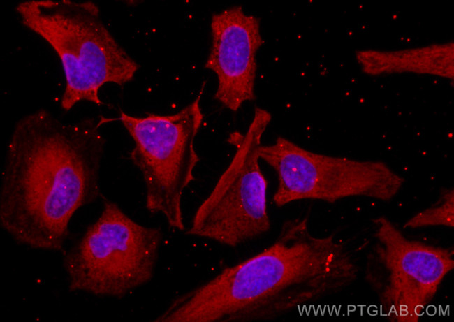 DNM2 Antibody in Immunocytochemistry (ICC/IF)