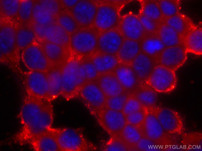 CCT2 Antibody in Immunocytochemistry (ICC/IF)