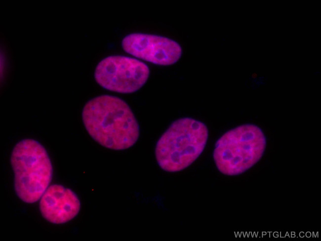 HNRNPD Antibody in Immunocytochemistry (ICC/IF)
