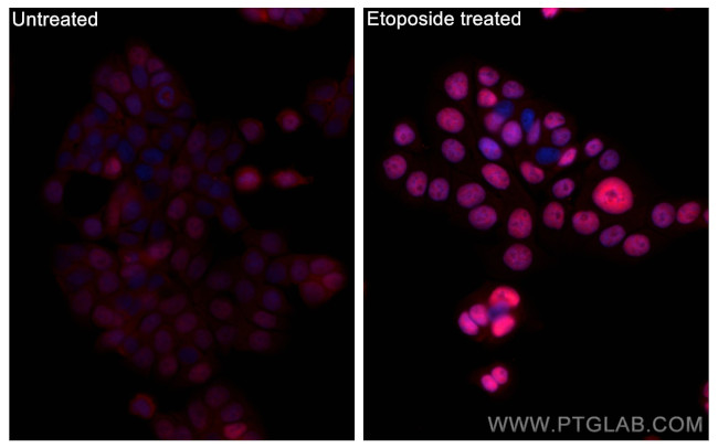 Phospho-P53 (Ser15) Antibody in Immunocytochemistry (ICC/IF)