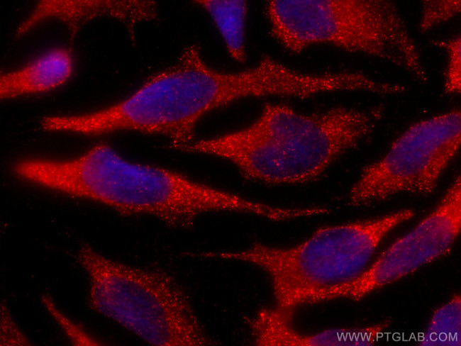 PEX14 Antibody in Immunocytochemistry (ICC/IF)